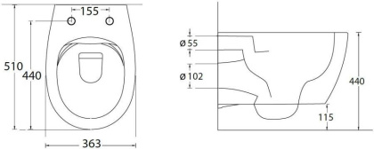 Подвесной унитаз Allen Brau Fantasy 4.11004.20